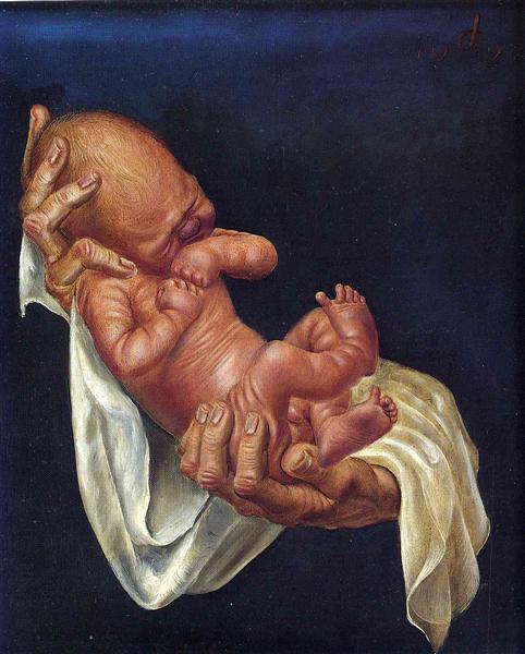 Newborn Baby on Hands, 1927 - Otto Dix