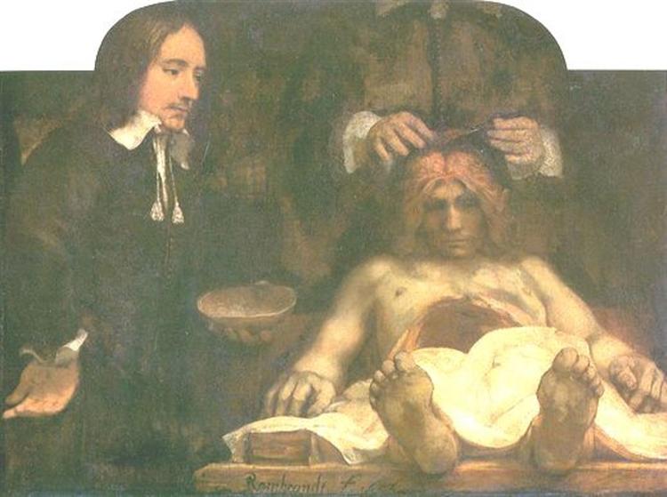 Anatomy of Doctor Deyman, 1656 - Rembrandt van Rijn